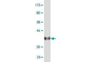 Western Blot detection against Immunogen (37. (HINT2 Antikörper  (AA 60-163))