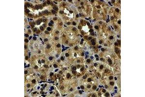 Immunohistochemical analysis of HCCR-1 staining in human kidney formalin fixed paraffin embedded tissue section.