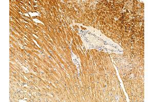 Phospho-MARK3 (Thr507) Antibody at 1/100 staining Rat heart tissue by IHC-P.