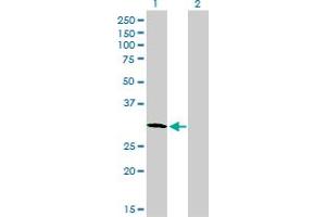 Western Blot analysis of PLSCR3 expression in transfected 293T cell line by PLSCR3 monoclonal antibody (M09), clone 2C8.