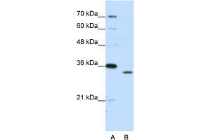 WB Suggested Anti-PSMA1 Antibody Titration:  1. (PSMA1 Antikörper  (N-Term))