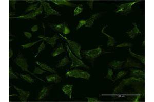 Immunofluorescence (IF) image for anti-Valosin Containing Protein (VCP) (AA 1-110) antibody (ABIN521311)