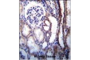 Immunohistochemistry (Paraffin-embedded Sections) (IHC (p)) image for anti-ATPase, H+ Transporting, Lysosomal 56/58kDa, V1 Subunit B1 (ATP6V1B1) (AA 284-310) antibody (ABIN655485)