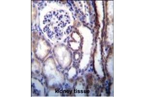 ATP6V1B1 Antibody (Center) (ABIN655485 and ABIN2845006) immunohistochemistry analysis in formalin fixed and paraffin embedded human kidney tissue followed by peroxidase conjugation of the secondary antibody and DAB staining.