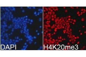 Immunofluorescence analysis of 293T cell using H4K20me3 antibody. (Histone 3 Antikörper  (3meLys20))