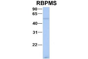 Host:  Rabbit  Target Name:  CHAD  Sample Type:  Human Adult Placenta  Antibody Dilution:  1. (RBPMS Antikörper  (N-Term))