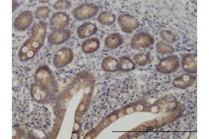 Immunohistochemistry (Formalin-fixed Paraffin-embedded Sections) (IHC (fp)) image for anti-Tyrosine Kinase 2 (TYK2) (AA 276-375) antibody (ABIN521186)