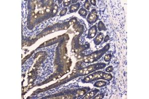 IHC testing of FFPE mouse small intestine tissue with COX4I1 antibody at 1ug/ml.