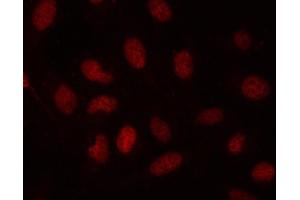 IF analysis of SDE2 using anti-SDE2 antibody (ABIN7599603). (C1orf55 Antikörper  (AA 10-447))