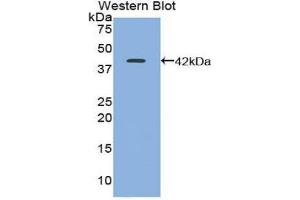Western Blotting (WB) image for anti-Trefoil Factor 1 (TFF1) (AA 1-87) antibody (ABIN1860706) (TFF1 Antikörper  (AA 1-87))
