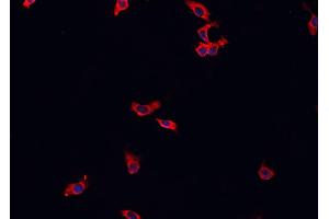 ABIN6269244 staining HeLa cells by IF/ICC. (MAP3K8 Antikörper  (Internal Region))