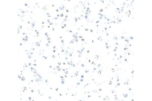 Immunocytochemistry (ICC) image for anti-Zinc Finger E-Box Binding Homeobox 1 (ZEB1) (AA 750-800) antibody (ABIN7455173) (Rekombinanter ZEB1 Antikörper  (AA 750-800))