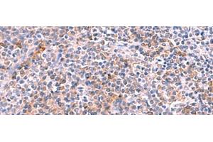 Immunohistochemistry of paraffin-embedded Human tonsil tissue using NCAN Polyclonal Antibody at dilution of 1:30(x200) (Neurocan Antikörper)