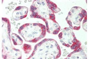 Rabbit Anti-PSG5 antibody  Formalin Fixed Paraffin Embedded Tissue: Human Placenta Primary antibody Concentration: 1:100 Secondary Antibody: Donkey anti-Rabbit-Cy3 Secondary Antibody Concentration: 1:200 Magnification: 20x Exposure Time: 0. (PSG5 Antikörper  (Middle Region))