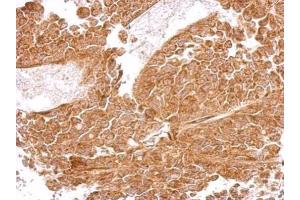 IHC-P Image MRPS5 antibody detects MRPS5 protein at cytosol on AGS xenograft by immunohistochemical analysis. (MRPS5 Antikörper)