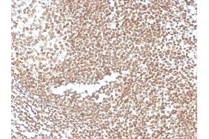 Formalin-fixed, paraffin-embedded human colon stained with P16INK4a Mouse Monoclonal Antibody (CDKN2A/3830). (CDKN2A Antikörper)