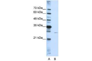 EMG1 antibody used at 0. (EMG1 Antikörper)