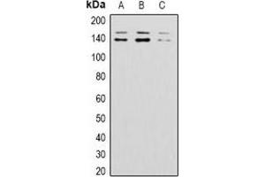 Western blot analysis of BAI1 expression in 293T (A), mouse brain (B), rat brain (C) whole cell lysates. (BAI1 Antikörper)