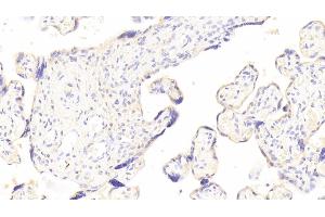 Detection of GM-CSF in Human Placenta Tissue using Polyclonal Antibody to Colony Stimulating Factor 2, Granulocyte Macrophage (GM-CSF) (GM-CSF Antikörper  (AA 18-144))