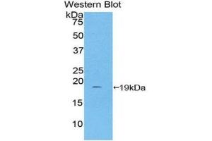 Western Blotting (WB) image for anti-Haptoglobin (HP) (AA 168-319) antibody (ABIN1859196) (Haptoglobin Antikörper  (AA 168-319))
