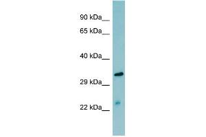 WB Suggested Anti-MASP2  Antibody Titration: 0. (MASP2 Antikörper  (N-Term))