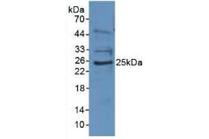 Figure. (EBI3 Antikörper  (AA 21-229))