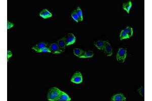 Immunofluorescent analysis of HepG2 cells using ABIN7148593 at dilution of 1:100 and Alexa Fluor 488-congugated AffiniPure Goat Anti-Rabbit IgG(H+L) (Coronin 1a Antikörper  (AA 363-432))