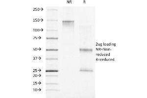 SDS-PAGE Analysis Purified Progesterone Receptor Mouse Monoclonal Antibody (PR500). (Progesterone Receptor Antikörper)
