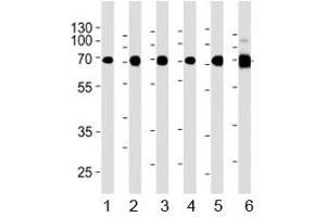 Acetylcholinesterase antibody western blot analysis in 1) human Raji, 2) human Jurkat, 3) human COS7, 4) mouse NIH3T3, 5) mouse cerebellum, and 6) rat cerebellum lysate. (Acetylcholinesterase Antikörper  (AA 587-611))