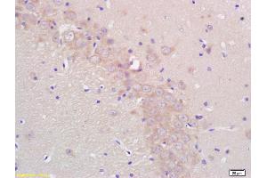 Formalin-fixed and paraffin embedded rat brain labeled with Rabbit Anti CYP19/CYP19A1 Polyclonal Antibody, Unconjugated (ABIN674529) at 1:200 followed by conjugation to the secondary antibody and DAB staining (Aromatase Antikörper  (AA 41-140))