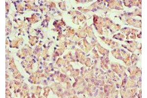 Immunohistochemistry of paraffin-embedded human pancreatic tissue using ABIN7155744 at dilution of 1:100 (HOXB7 Antikörper  (AA 1-120))