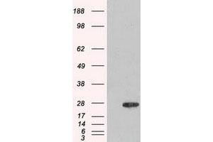 Image no. 1 for anti-Adenylate Kinase 1 (AK1) antibody (ABIN1496515)