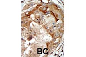 Immunohistochemistry (Paraffin-embedded Sections) (IHC (p)) image for anti-serum/glucocorticoid Regulated Kinase Family, Member 3 (SGK3) (AA 108-139) antibody (ABIN1882132)