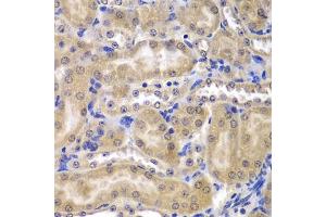 Immunohistochemistry of paraffin-embedded mouse kidney using RPL5 antibody (ABIN3015785, ABIN3015786, ABIN3015787 and ABIN6219135) at dilution of 1:200 (40x lens). (RPL5 Antikörper  (AA 1-95))