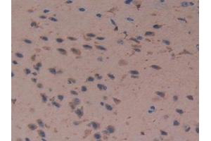 Detection of Cys-C in Mouse Cerebrum Tissue using Polyclonal Antibody to Cystatin C (Cys-C) (CST3 Antikörper  (AA 21-140))