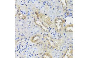 Immunohistochemistry of paraffin-embedded rat kidney using CTSC antibody at dilution of 1:100 (x40 lens). (CTSC Antikörper)