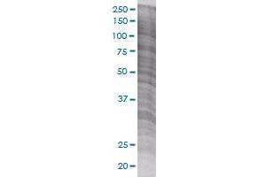 CNR1 transfected lysate. (CNR1 293T Cell Transient Overexpression Lysate(Denatured))