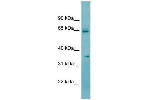 WB Suggested Anti-KHK Antibody Titration:  0. (Ketohexokinase Antikörper  (N-Term))