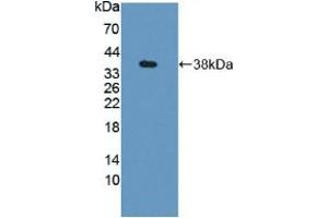 Figure. (GBP4 Antikörper  (AA 1-304))