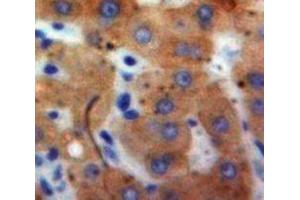 Used in DAB staining on fromalin fixed paraffin-embedded Liver tissue (IFNA21 Antikörper  (AA 25-189))