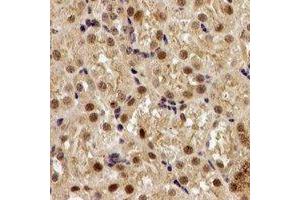 Immunohistochemical analysis of EGLN1 staining in human kidney formalin fixed paraffin embedded tissue section.