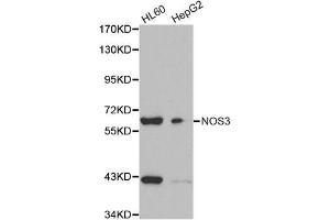 Western blot analysis of extracts of HL60 and HepG2 cell lines, using NOS3 antibody. (ENOS Antikörper)