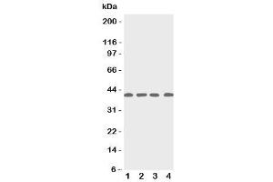 Western blot testing of p53R2 antbody (RRM2B Antikörper  (C-Term))