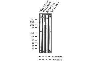 Western blot analysis of Phospho-ATF2 (Ser112 or 94) expression in various lysates (ATF2 Antikörper  (pSer94, pSer112))