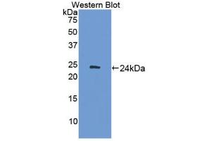 Western blot analysis of the recombinant protein. (ADCY7 Antikörper  (AA 309-491))