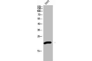 Western Blot analysis of 293T cells using ZNF695 Polyclonal Antibody (ZNF695 Antikörper  (Internal Region))