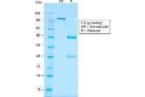 SDS-PAGE Analysis of Purified WT1 Mouse Recombinant Monoclonal Antibody ABIN6383829. (Rekombinanter WT1 Antikörper)