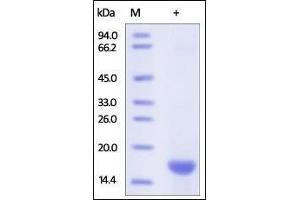 Human FABP5, His Tag on SDS-PAGE under reducing (R) condition. (FABP5 Protein (AA 2-135) (His tag))