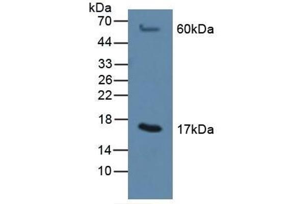 MGST1 antibody  (AA 8-155)