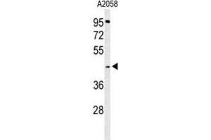 Western Blotting (WB) image for anti-Trans-2,3-Enoyl-CoA Reductase (TECR) antibody (ABIN3004322) (TECR Antikörper)